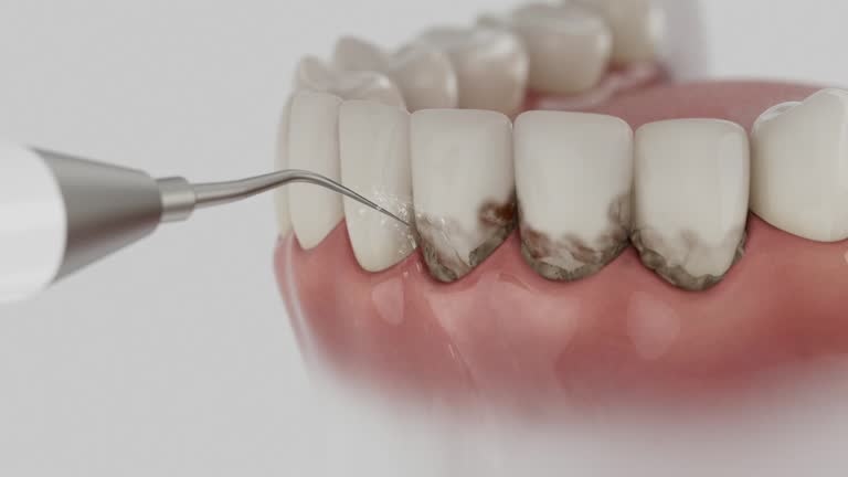 Reliable Wisdom Tooth Removal contractor in Madison County County, GA by Dentist Open Now